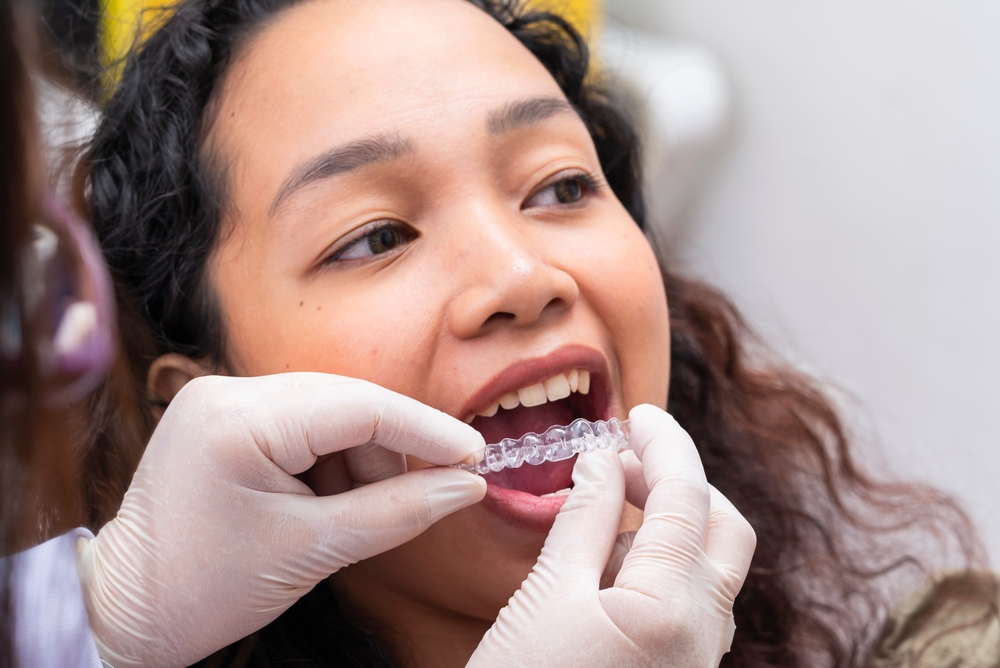 Invisalign roseville